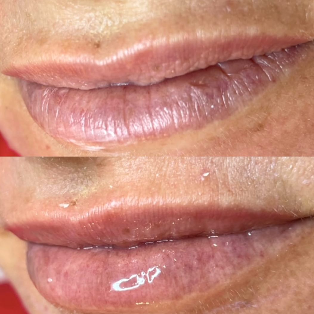 Antes e depois — hydra gloss